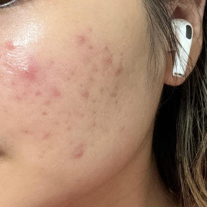 Centella Probio-Cica Intensive Ampoule